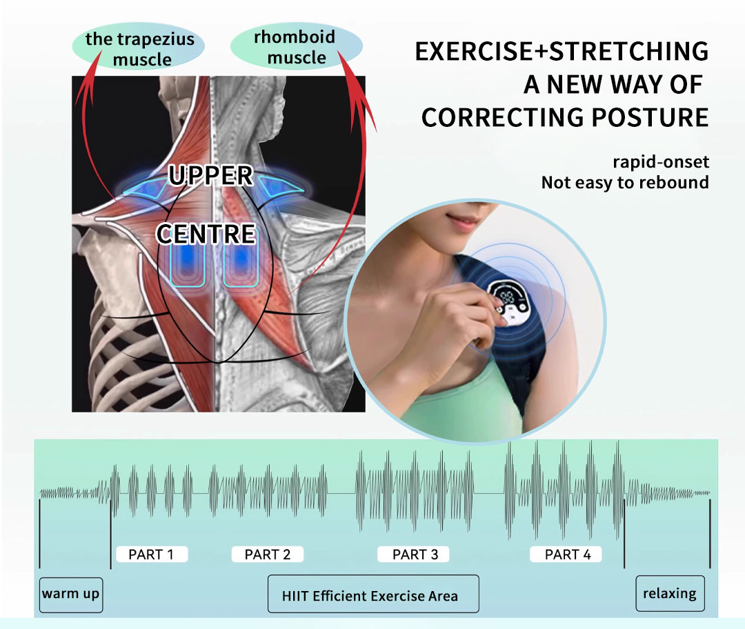 Microcurrent Posture Device Fo - Posture Corrector Back のレビューと価格